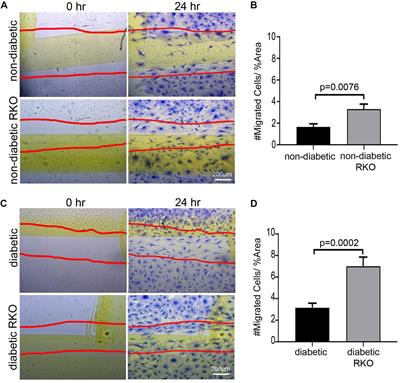 The Impact of Diabetic Conditions and AGE/RAGE Signaling on Cardiac Fibroblast Migration